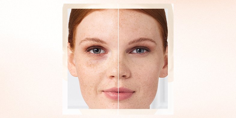 BMAG InArticleImagery Tips For Concealing Dark Under Eye Circles Fast 2